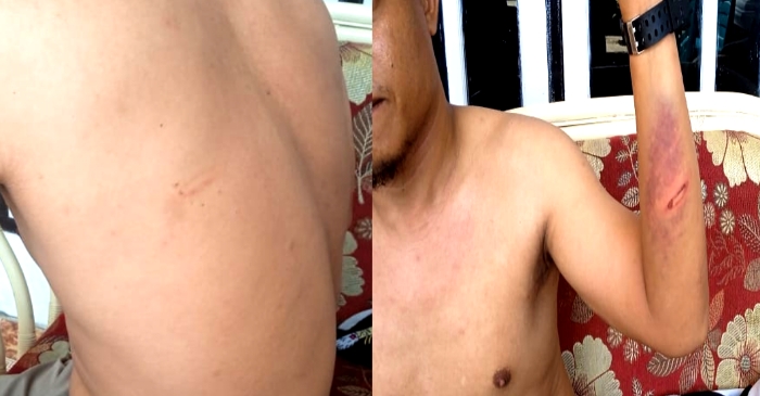Oknum Polisi di Pohuwato Diduga Aniaya Warga Marisa Utara Hingga Memar  Oknum Polisi di Pohuwato Diduga Aniaya Warga Marisa Utara Hingga Memar